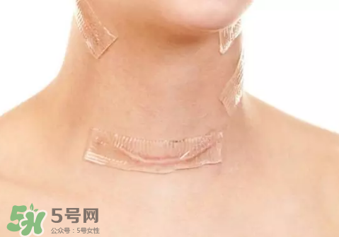 硅膠疤痕貼有用嗎？硅膠疤痕貼效果怎么樣？