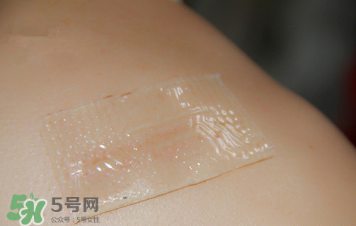 仙卡疤痕貼有用嗎？仙卡疤痕貼效果怎么樣？