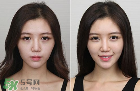 蘋果肌怎么化？蘋果肌究竟哪里好？