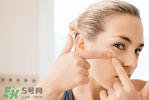 暗瘡可以擠壓嗎？油性和骯臟肌膚會容易有暗瘡嗎？