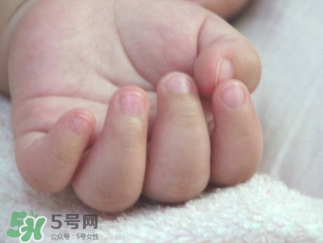 寶寶手指甲有白痕怎么回事？幼兒手指甲發(fā)白是缺鈣嗎
