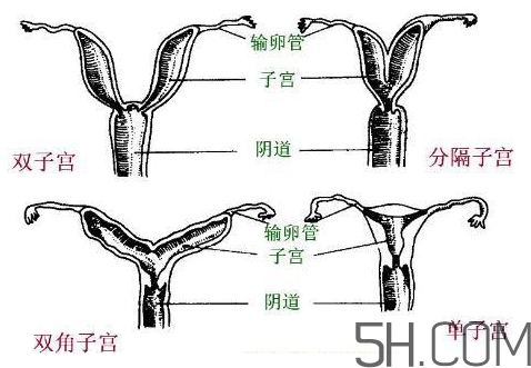 子宮畸形有哪些？子宮畸形有什么影響？