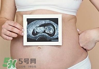 雙子宮可以上環(huán)嗎？雙子宮上環(huán)要注意哪些？