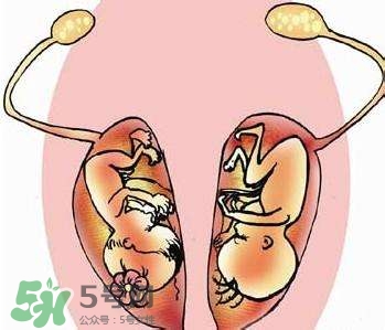 雙子宮對懷孕有影響嗎？雙子宮懷孕要注意什么？