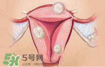 雙子宮可以上環(huán)嗎？雙子宮上環(huán)要注意哪些？