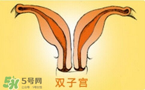 雙子宮是什么意思？雙子宮可以順產嗎？