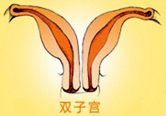 雙子宮是什么意思？雙子宮可以順產(chǎn)嗎？