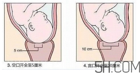 內(nèi)檢是什么感覺？內(nèi)檢有男醫(yī)生嗎？