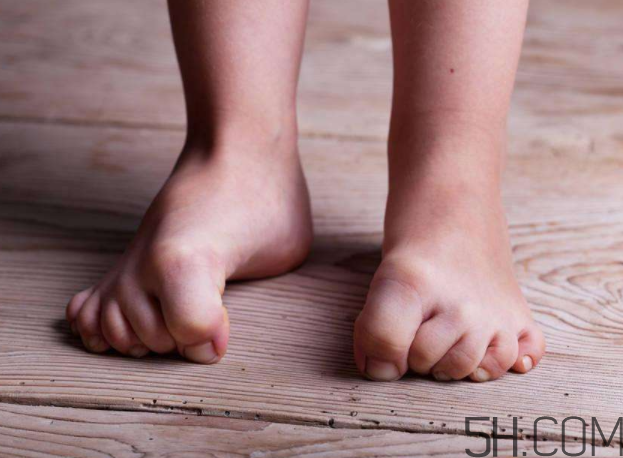 腳氣會(huì)通過床單傳染嗎？腳氣會(huì)傳染給嬰兒嗎？