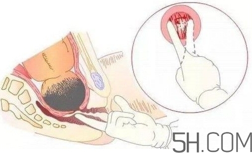 內(nèi)檢是什么感覺？內(nèi)檢有男醫(yī)生嗎？