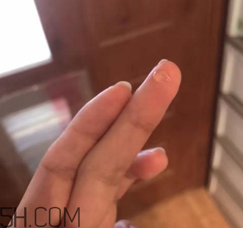 倍舒痕可以去痘印嗎？倍舒痕能涂在痘痘上嗎？
