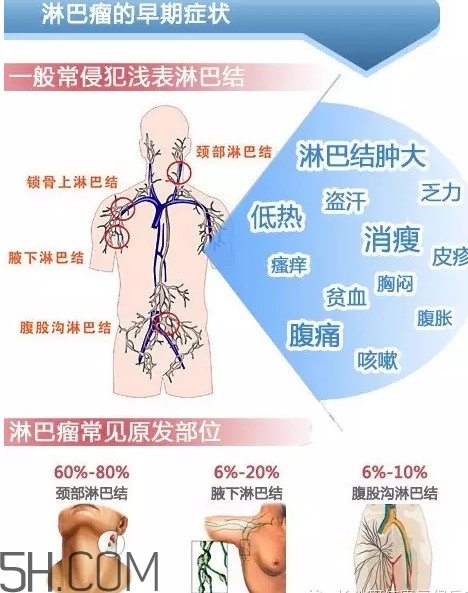 淋巴癌是怎么回事？淋巴癌如何診斷