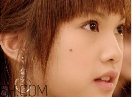 痣是怎么形成的？女人痣長(zhǎng)哪里最有福氣