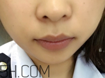 小蜜蜂細(xì)致修護(hù)唇膏很油嗎？夏天用合適嗎？