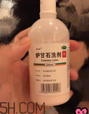 爐甘石洗劑是洗還是擦？爐甘石洗劑是什么顏色？