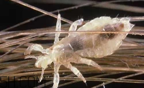 孩子長虱子是怎么回事？孩子長虱子該怎么辦？