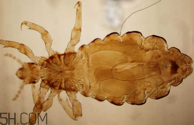 孩子長虱子是怎么回事？孩子長虱子該怎么辦？