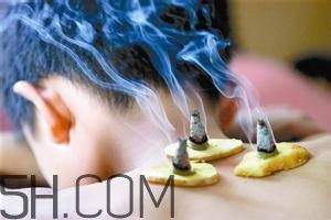 艾灸對慢性咽炎有用嗎？慢性咽炎可以通過艾灸來治療嗎？