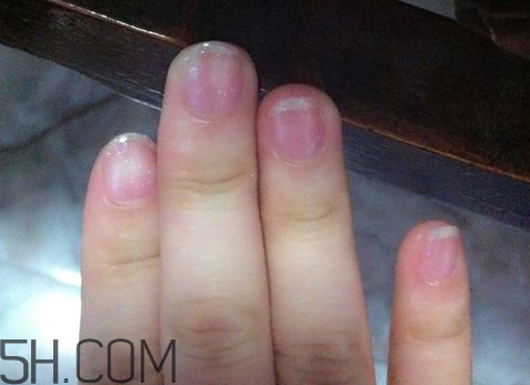 美甲后指甲受損怎么辦？指甲破損怎么修復(fù)？
