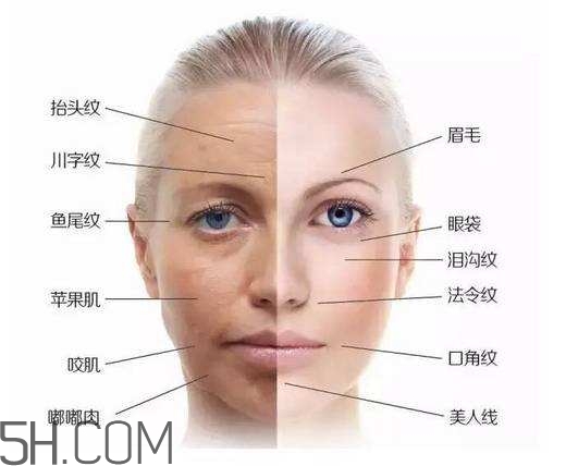 怎么預(yù)防皺紋的產(chǎn)生？導(dǎo)致皺紋的產(chǎn)生的原因有哪些？