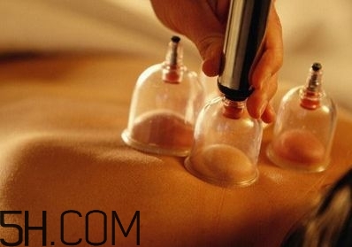拔罐可以治療鼻炎嗎？鼻炎拔罐拔哪里？