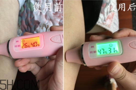水楊酸可以去黑頭嗎？水楊酸可以去閉口嗎