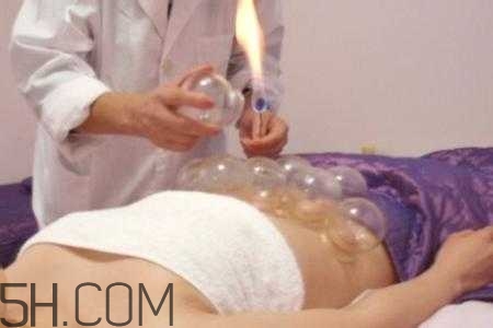 腹部拔罐可以減肥嗎？腹部拔罐拔哪個位置？