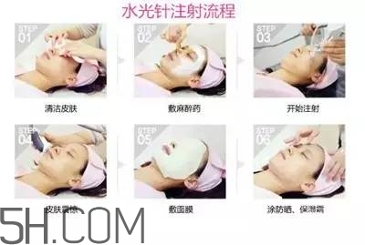 打水光針多久打一次？水光針的誤區(qū)