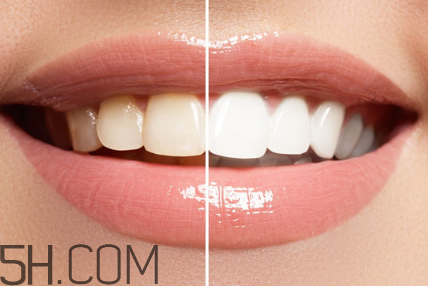 牙齒內(nèi)側(cè)的黃垢怎么去除？每天刷幾次牙齒最合適？