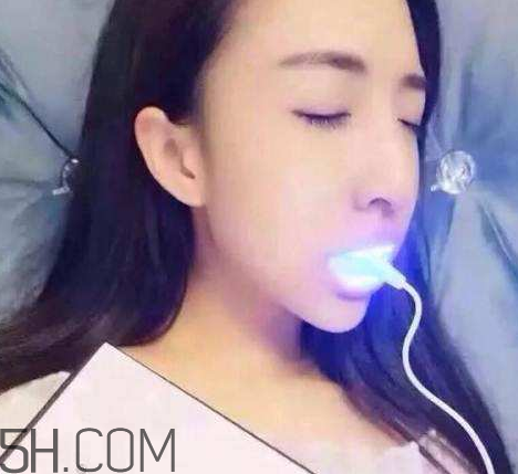 美牙儀可以兩個人用嗎？美牙儀用多久才有作用？