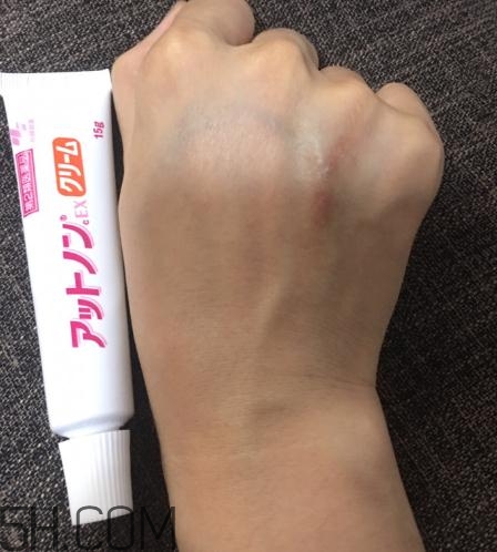 小林制藥祛疤膏有效嗎？小林制藥祛疤膏怎么樣？