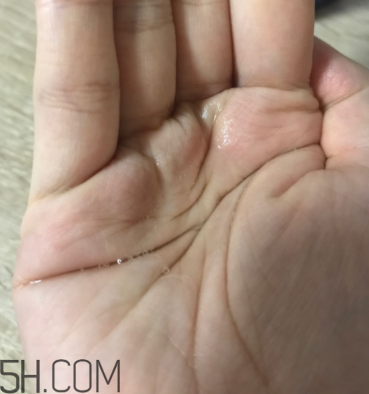 雪肌精卸妝油糊眼睛嗎？雪肌精卸妝油悶痘嗎？