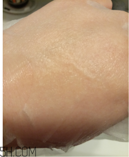 WIS痘肌修護(hù)面膜有效嗎？適合敏感肌嗎？