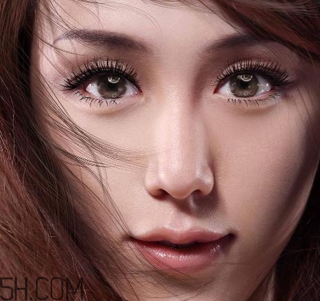 上瞼提肌手術(shù)有必要嗎？上瞼提肌后是永久的嗎？