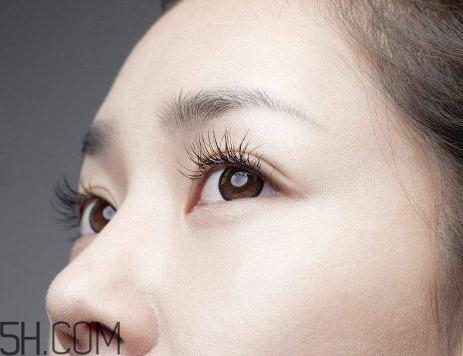 上瞼提肌手術(shù)有必要嗎？上瞼提肌后是永久的嗎？