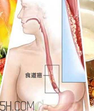 吃太燙會得癌？燙食不僅對胃不好還容易得癌