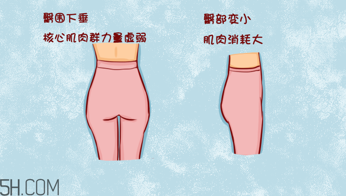 臀部護理對健康有什么影響？日常如何保養(yǎng)臀部健康？