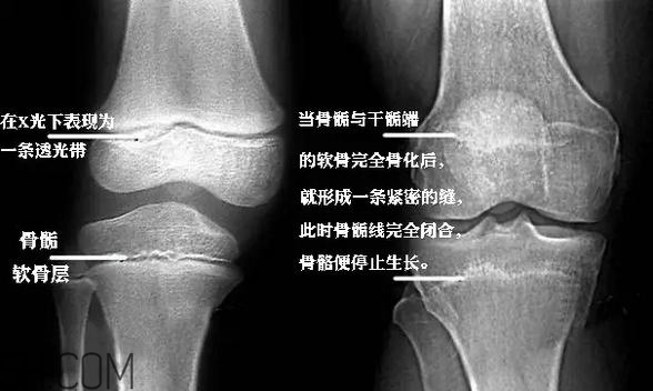 孩子學(xué)街舞好不好？學(xué)街舞好處多多
