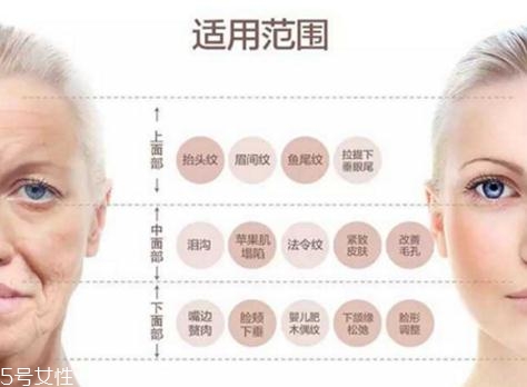 大v線會斷嗎？一定要選擇正規(guī)整形醫(yī)院