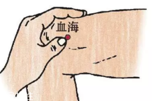 濕疹怎么治才管用？?jī)?nèi)外同治是關(guān)鍵