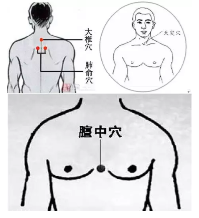 吮痧有什么療效？最溫柔的治病方法