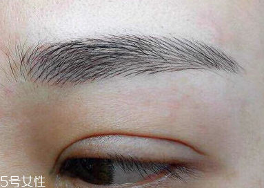 激光洗眉恢復期有疤痕怎么辦？激光洗眉毛之后正確護理方法