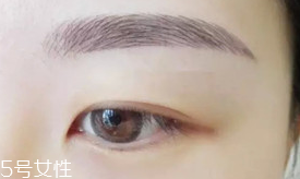 激光洗眉恢復期有疤痕怎么辦？激光洗眉毛之后正確護理方法