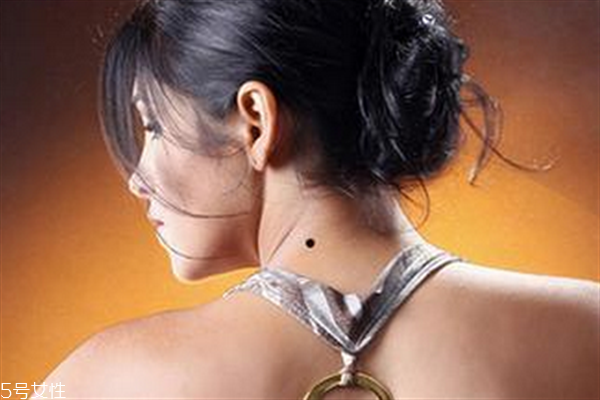 脖子后面有痣代表什么？10大身體缺陷是好事