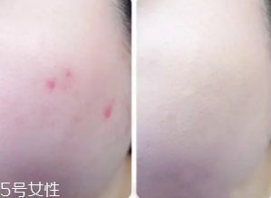 cpb遮瑕棒怎么樣？來看看使用效果