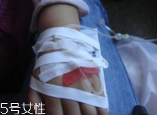 輸液治療不適合哪些??？過敏反應(yīng)危害大