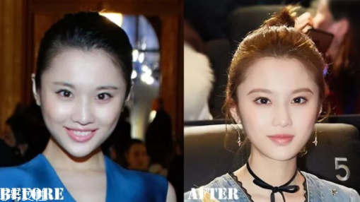 瑯琊榜2張慧雯整容了嗎？換了妝發(fā)美到不認識