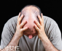 脫發(fā)有沒(méi)有治？只要不是禿子就有得治