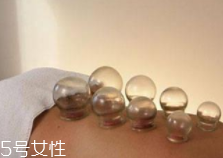 拔火罐引火上身的原因是什么？這4點(diǎn)要注意