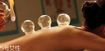 拔火罐引火上身的原因是什么？這4點(diǎn)要注意